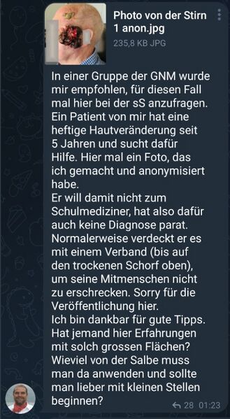 Datei:Schwarze Salbe Andreas Gross.jpg